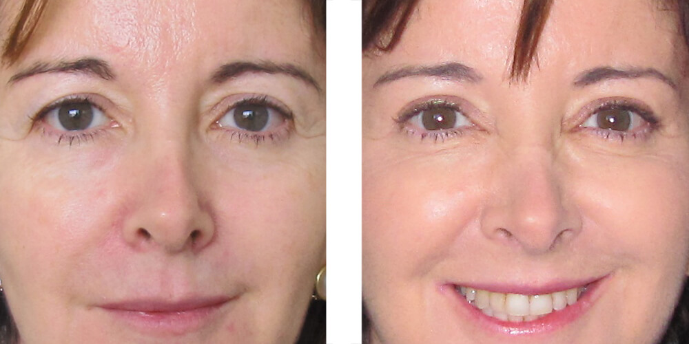 chirurgie esthetique tunisie